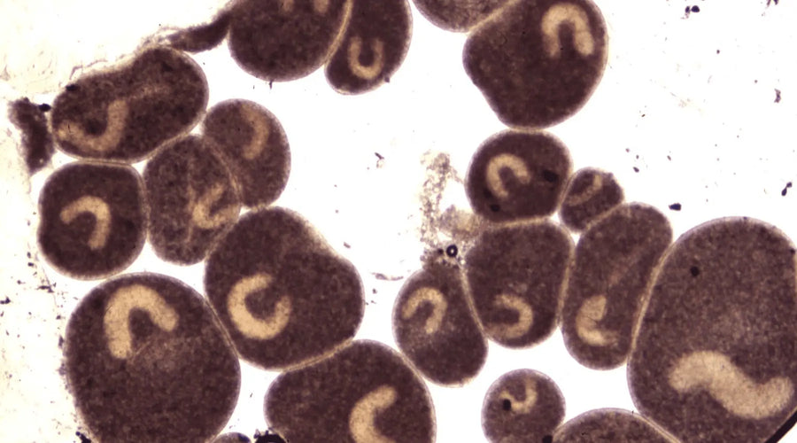Things About ICH Fish Diseases